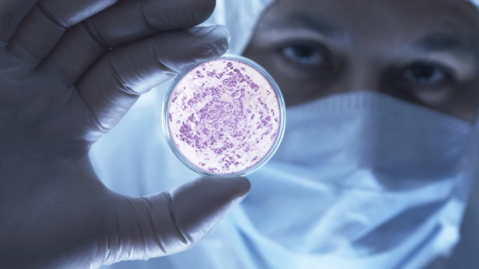 Infectious Diseases and Clinical Microbiology