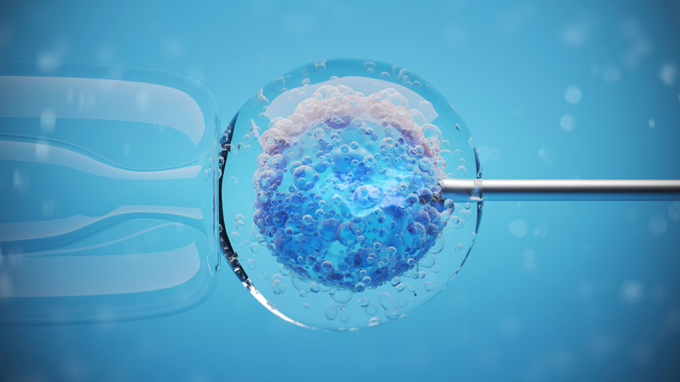In vitro fertilization (IVF) 