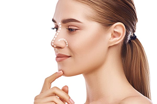 Rhinoplasty