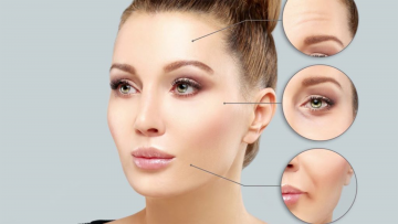 Botox injections