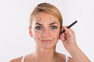 Face Lift