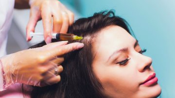 علاج الشعر بالبلازما الغنية بالصفائح الدموية (PRP) للشعر