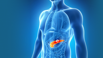 Pancreatic cancer