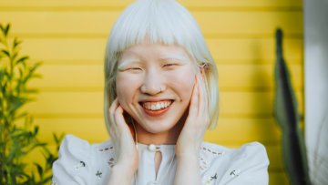 What is albinism? symptoms and treatment