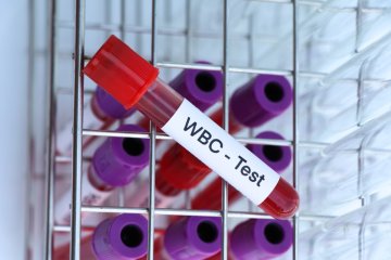 What is Increased WBC Count?