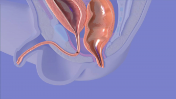 Anorectal surgery