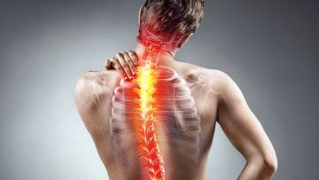 Waist, neck and back hernias