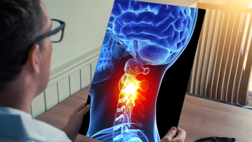Head and Neck Cancer Surgery