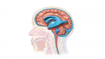 الإستسقاء الدماغي