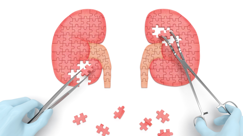 WHAT IS A RENAL TUMOR?