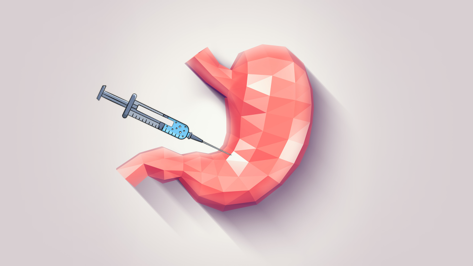 Was ist ein Magen-Botox?