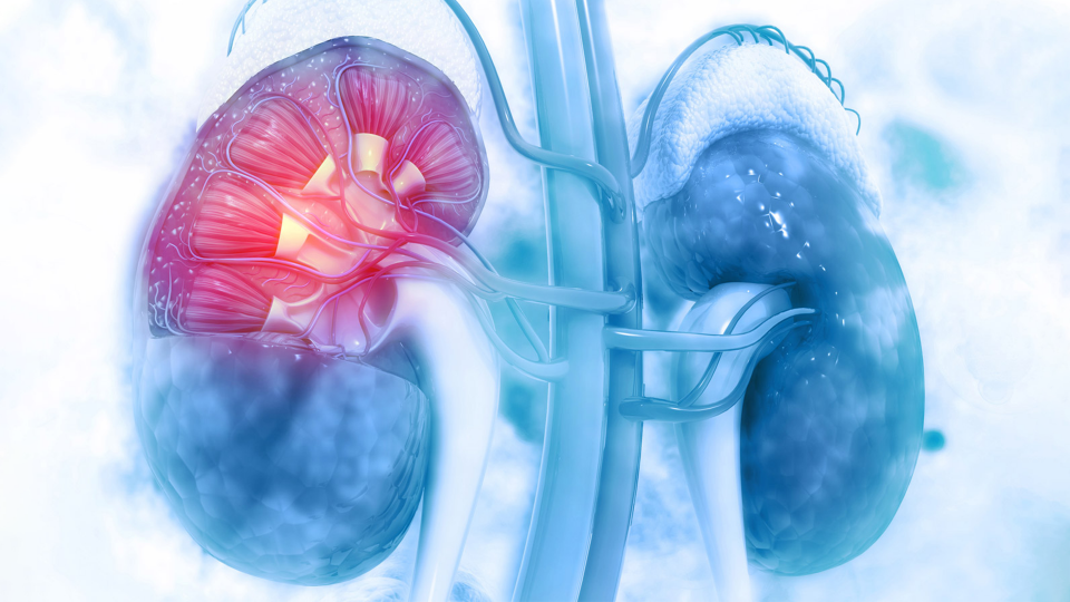 WHAT ARE KIDNEY TUMORS?