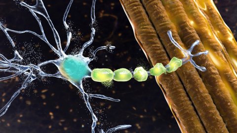 What is ALS? What are the stages and causes of ALS? 2