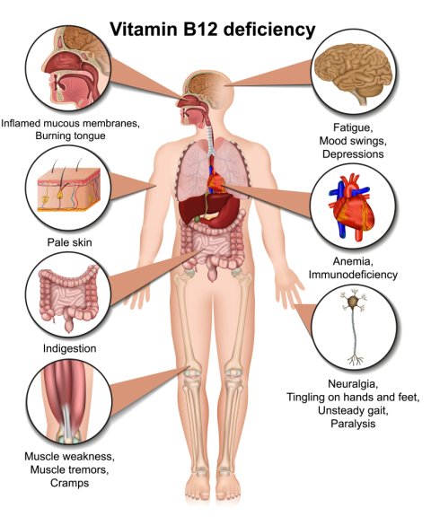 Vitamin B12 Deficiency: Causes, Symptoms and Treatment 1