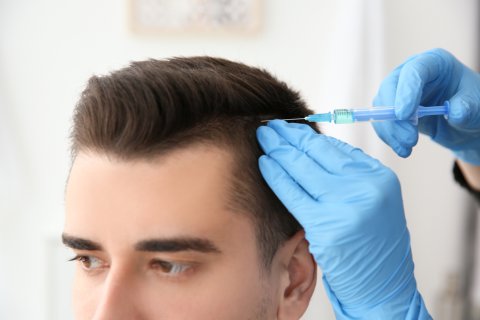 Hair Transplant in 20 Questions 2